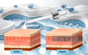 Ilustração mostrando a aplicação de um sérum na pele com as camadas antes e depois do tratamento, destacando a regeneração, hidratação e fortalecimento do colágeno e elastina.
