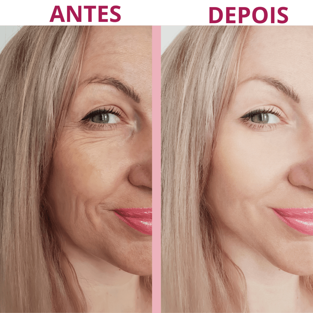 Comparativo visual antes e depois do uso do sérum Rosa Amazônica, mostrando redução visível de rugas ao redor dos olhos e melhora da textura da pele.