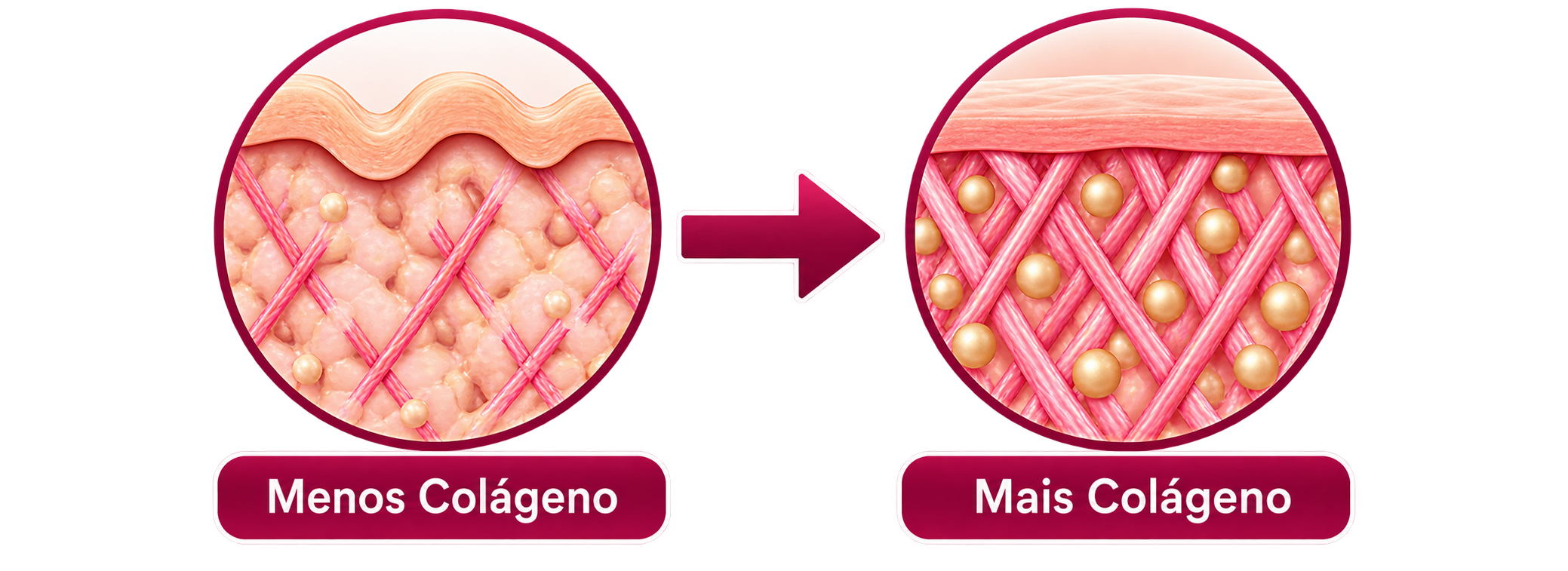 Retinol para Peles Maduras e comparação da estrutura da pele com menos e mais colágeno
