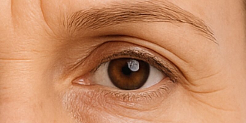 Close-up de rugas ao redor dos olhos, conhecidas como pés de galinha, um dos sinais mais comuns do envelhecimento da pele.