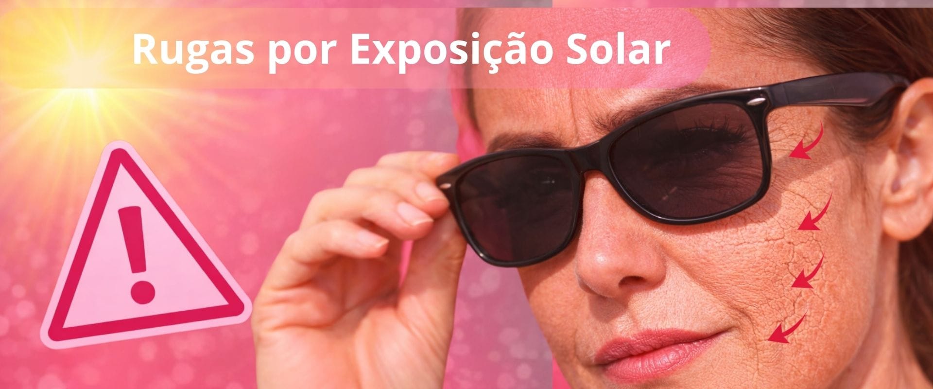 rugas por exposição solar e envelhecimento da pele causado pelo sol.