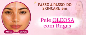Skincare passo a passo para pele oleosa com rugas mostrando antes e depois da redução da oleosidade e melhora da textura da pele.