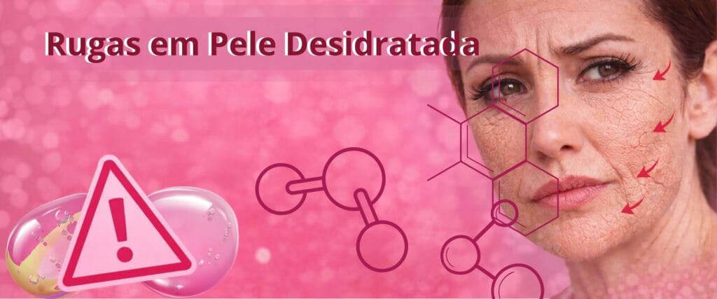 Rugas em pele desidratada no rosto feminino mostrando sinais de ressecamento e pele enrugada.
