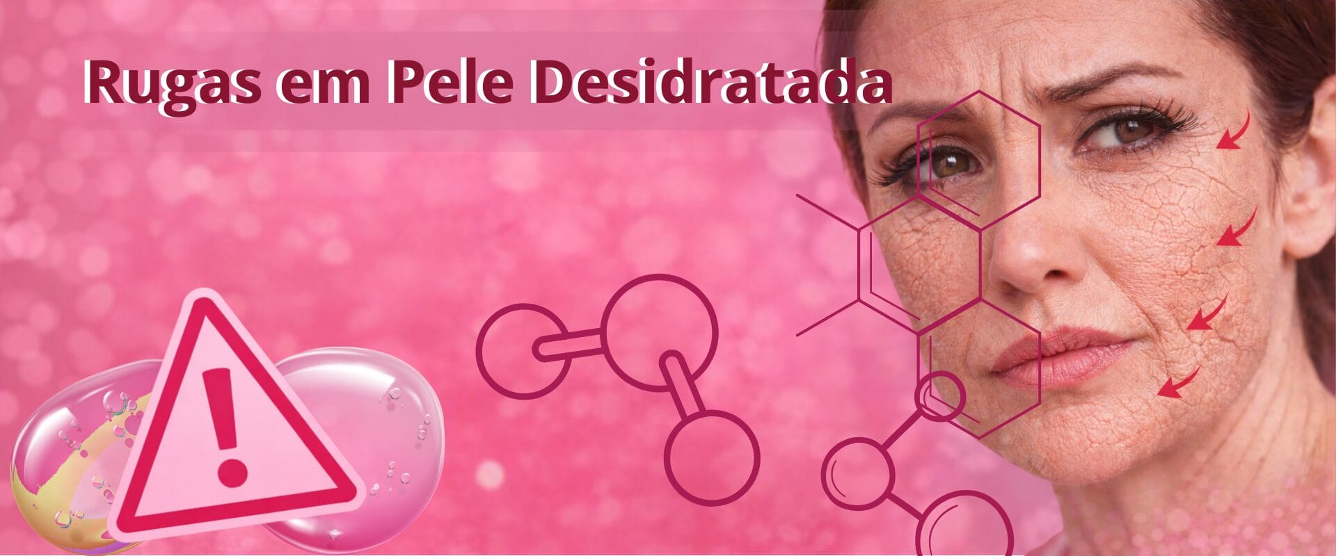 Rugas em pele desidratada no rosto feminino mostrando sinais de ressecamento e pele enrugada.