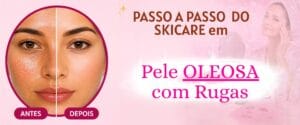 Skincare passo a passo para pele oleosa com rugas mostrando antes e depois da redução da oleosidade e melhora da textura da pele.